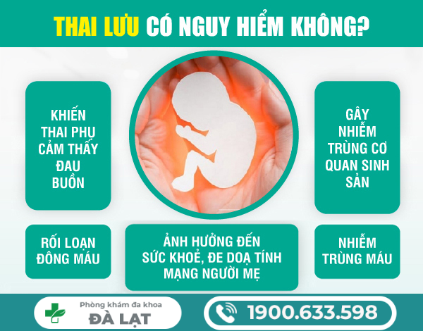 Hình ảnh minh họa